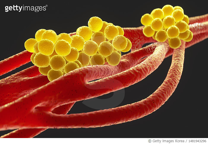 1481943296 | 게티이미지코리아 | Close-up of Staphylococcus aureus bacteria ...